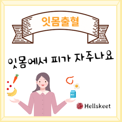 잇몸출혈 잇몸에서 피가 자주나요